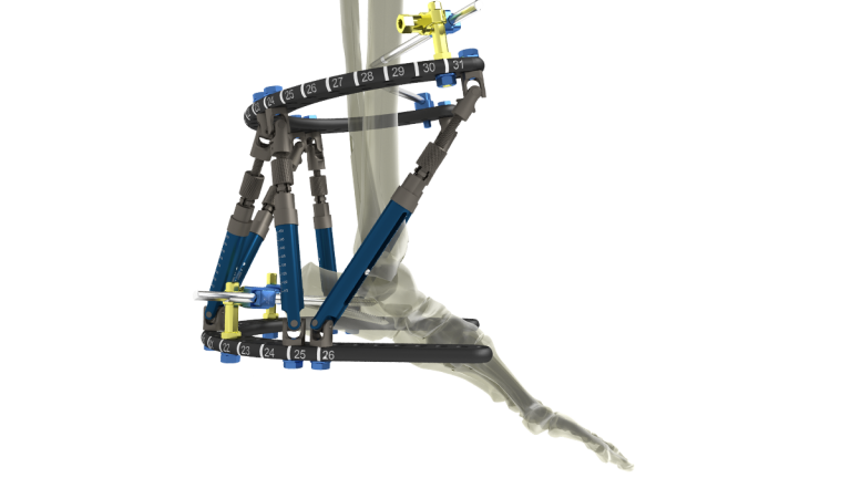 Product-_Smart_Correction_Foot_Frame