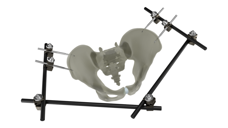 Product-_UniX_LargeBar-_Pelvic